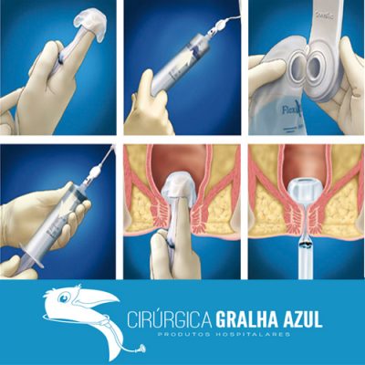 SISTEMA DE CONTROLE DA INCONTINÊNCIA FECAL FLEXISEAL - CONVATEC - Imagem 2